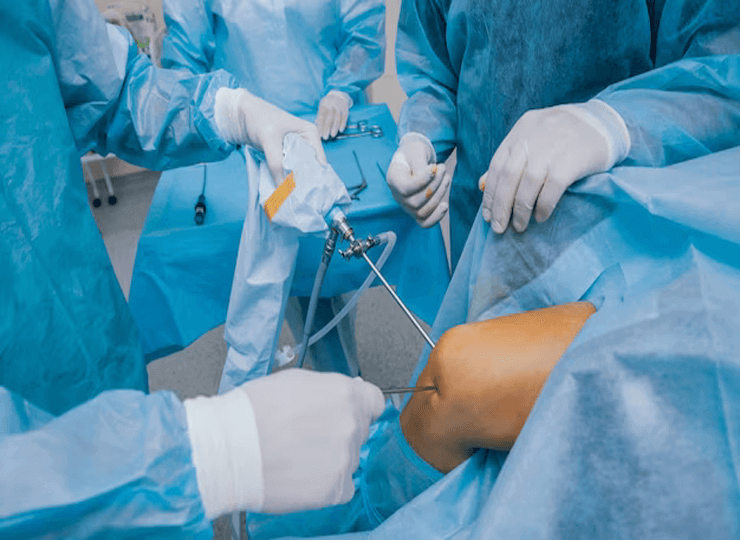 Arthoscopic  Surgery